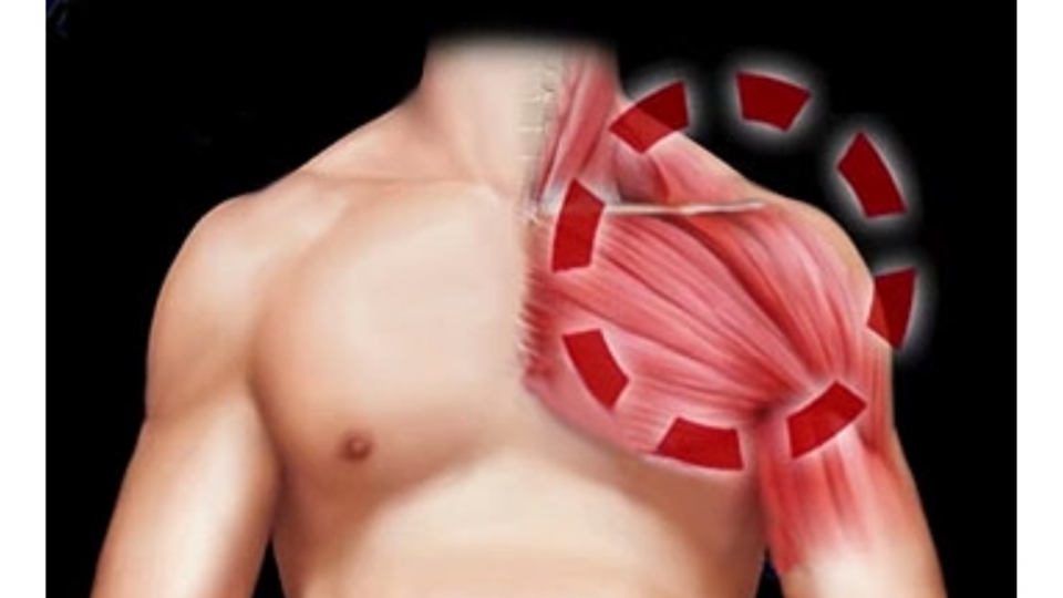 Болит левое плече у мужчины. Мышцы ключицы.